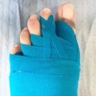 img Pansement indispensable � la consolidation en bonne position de votre chirurgie