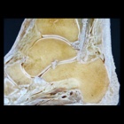 img Coupe anatomique montrant le cartilage articulaire