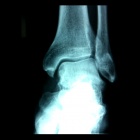 img Radiographie d