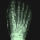 img Radiographie post op�ratoire