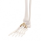 img M�dio-pied