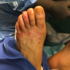 img Sans arthrod�se