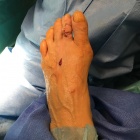 img Arthrod�se