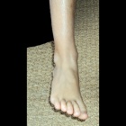 img Le pied interm�diaire