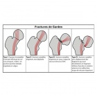 img Classification de Garden