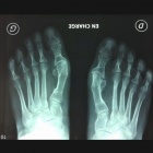 img S�quelles de chirurgie d