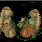img Image 3D