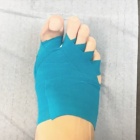 img Pansement post op�ratoire