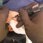 img Ost�otomie de la phalange 